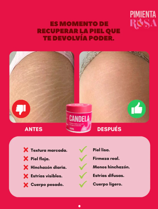 CREMA CANDELA 2X1 - ELIMINA LAS ESTRIAS