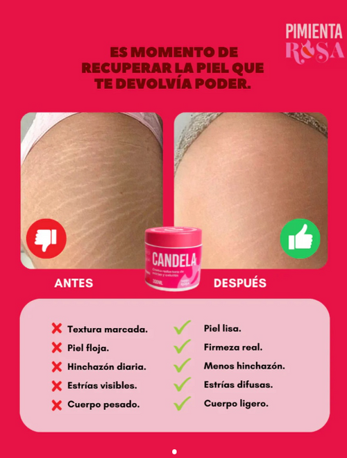 CREMA CANDELA 2X1 - ELIMINA LAS ESTRIAS